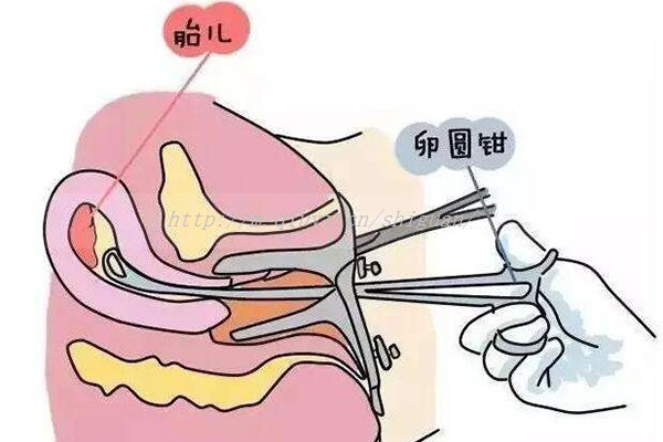 促排卵生出的孩子是否健康？答案竟出乎意料