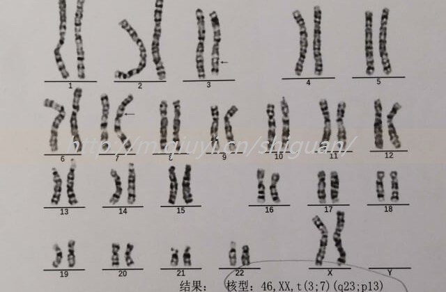 用头发自测怀孕怎么测？别再被“土方法”忽悠了