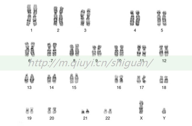 AMH值0.31会不会影响以后受孕？害怕做试管就先调理看看