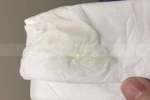 海盐生理盐水滴鼻有什么好处？详解生理盐水喷鼻的作用及功效