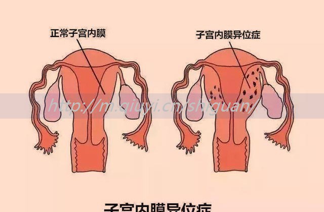 试管前b超为什么要月经时做？#胚胎移植